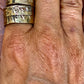 AP/ ANILLO POESÍA